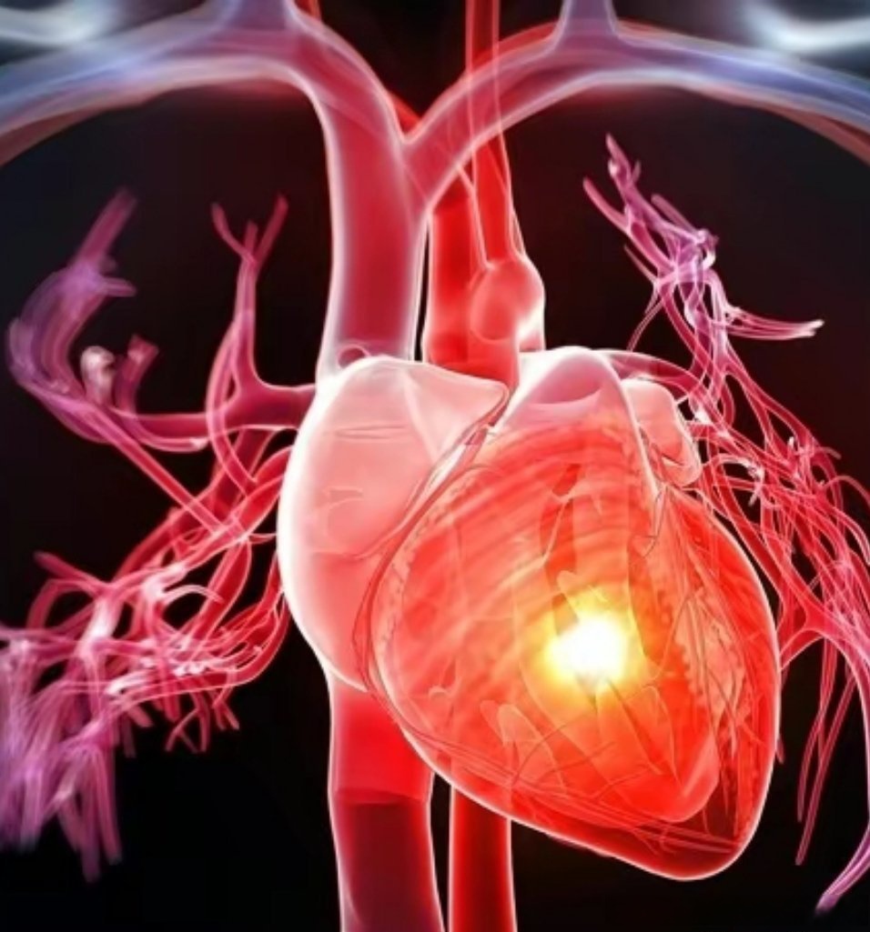 心源性猝死用速效救心丸有用吗